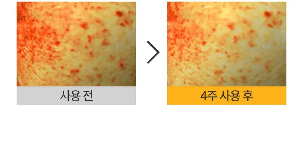 [잡티흔적케어/광채 PDRN] 로벡틴 비타 더블 토닝 크림 50ml 상세페이지 25